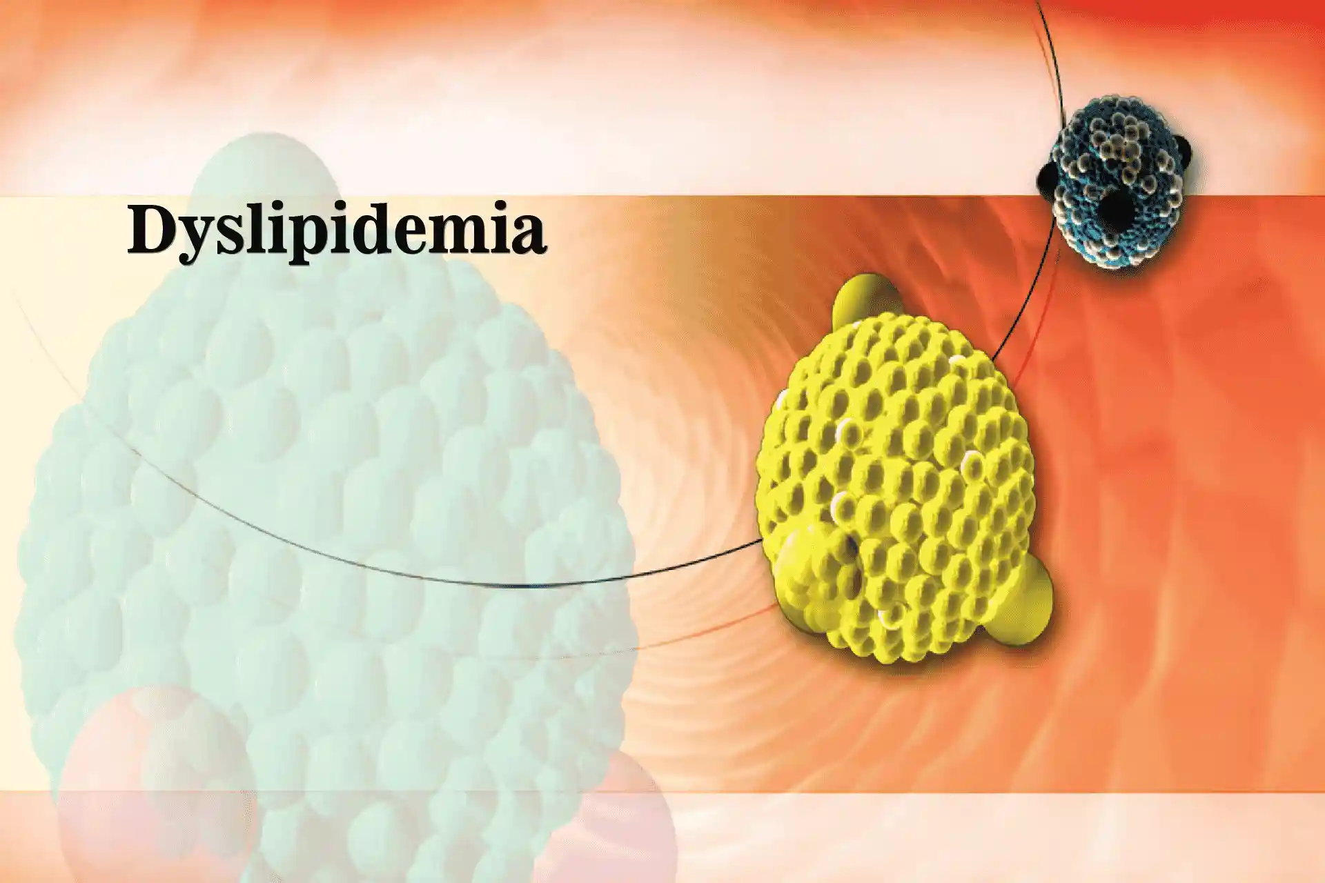 Dyslipidemia