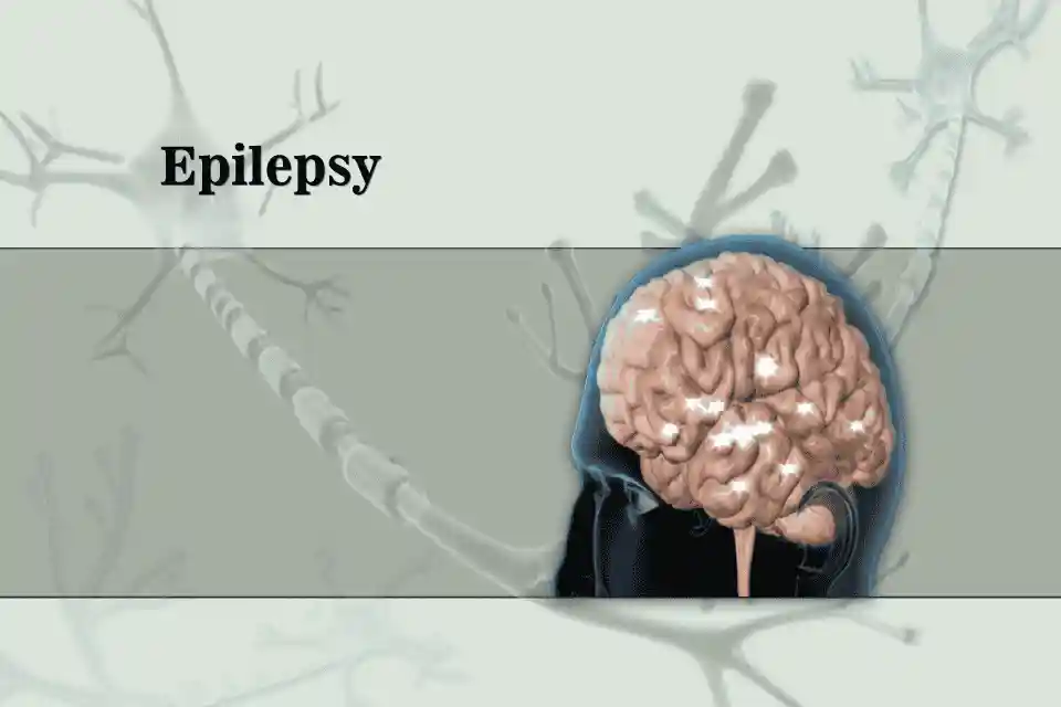 Epilepsy